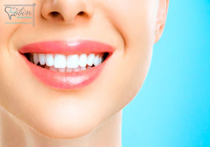 مقایسه کامپوزیت دندان با سایر روش های درمانی
